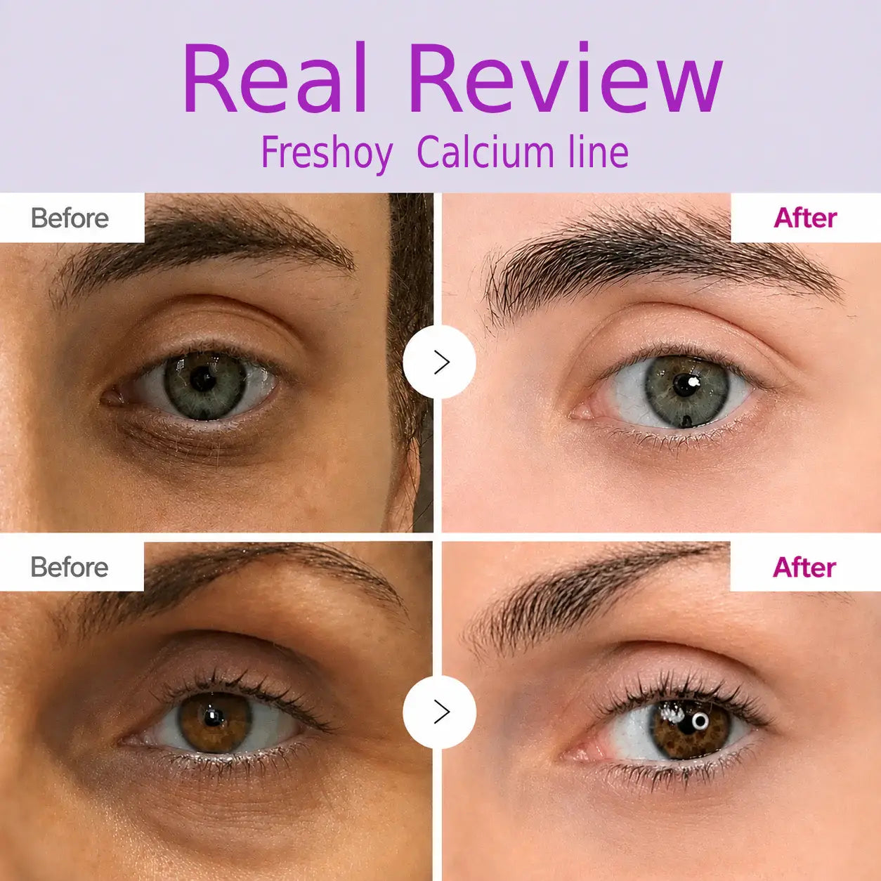 🔥LAST DAY 50% OFF!!Freshooy Korean Calcium Dark Spot Eye Cream