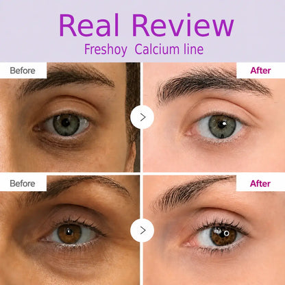 🔥LAST DAY 50% OFF!!Freshooy Korean Calcium Dark Spot Eye Cream
