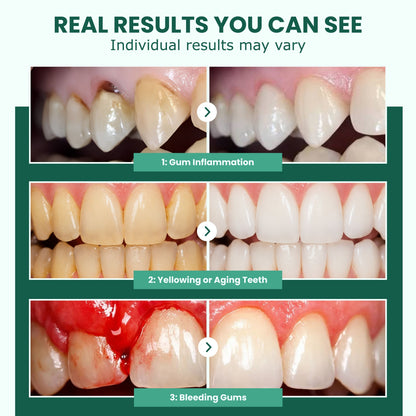 Freshooy - Teeth Repair Gel